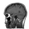 Brain